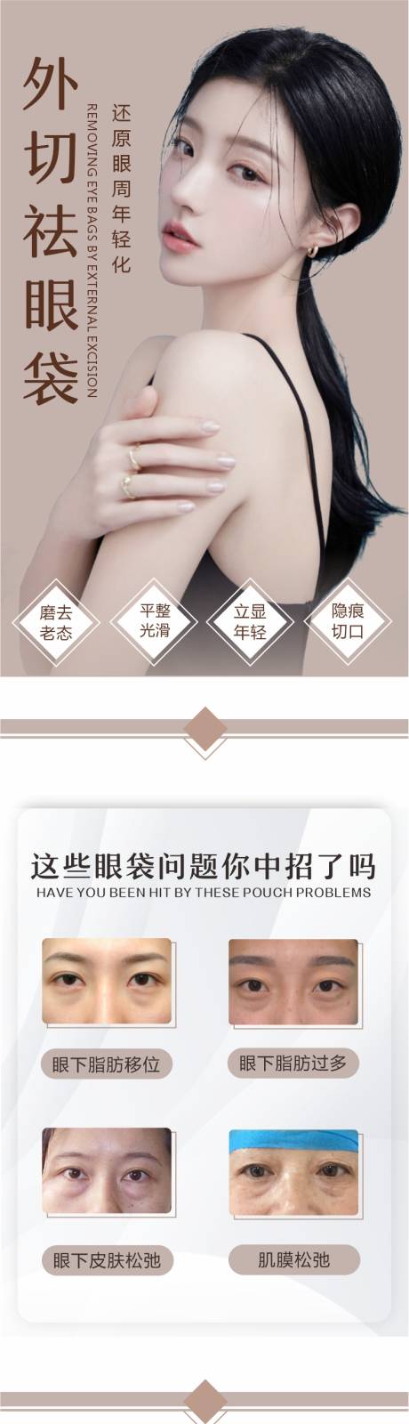 源文件下载【外切祛眼袋详情页】编号：38820005789375851
