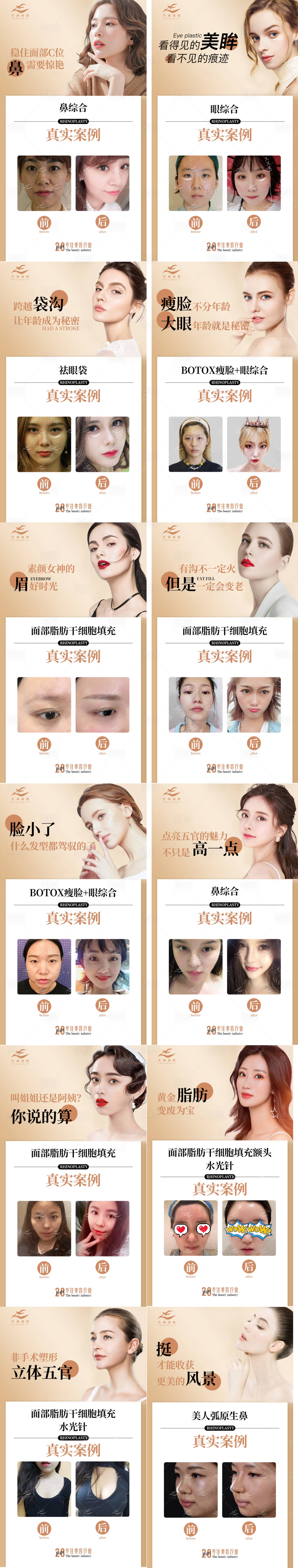 源文件下载【享设计】搜索编号：44920005700672522【医美案例系列12个】