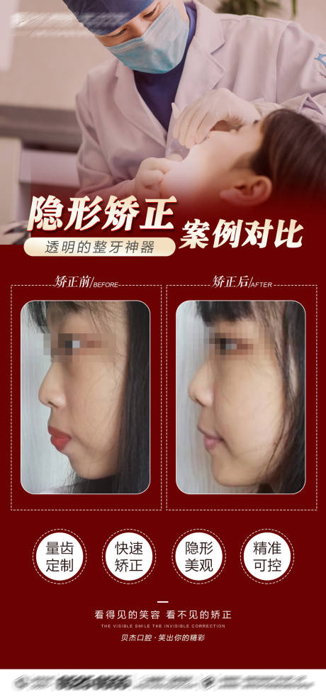 源文件下载【口腔隐形矫正案例海报】编号：36130005832079202