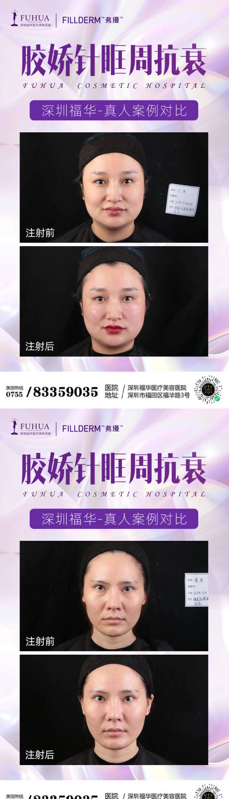 源文件下载【胶娇针案例对比海报】编号：68930005679907326
