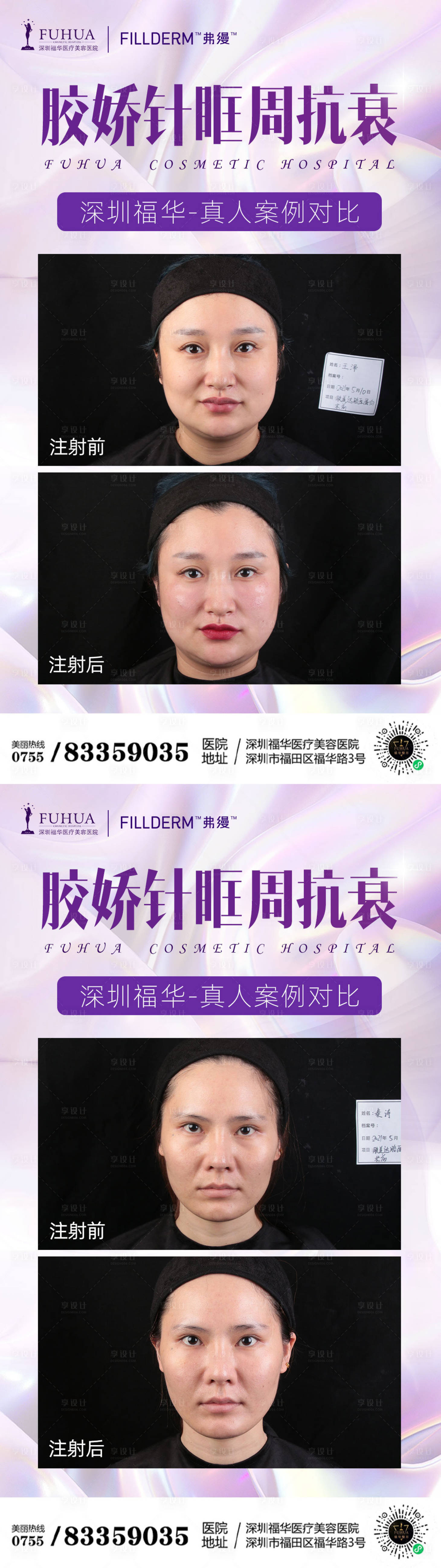 源文件下載【享設計】搜索編號：68930005679907326【膠嬌針案例對比海報】