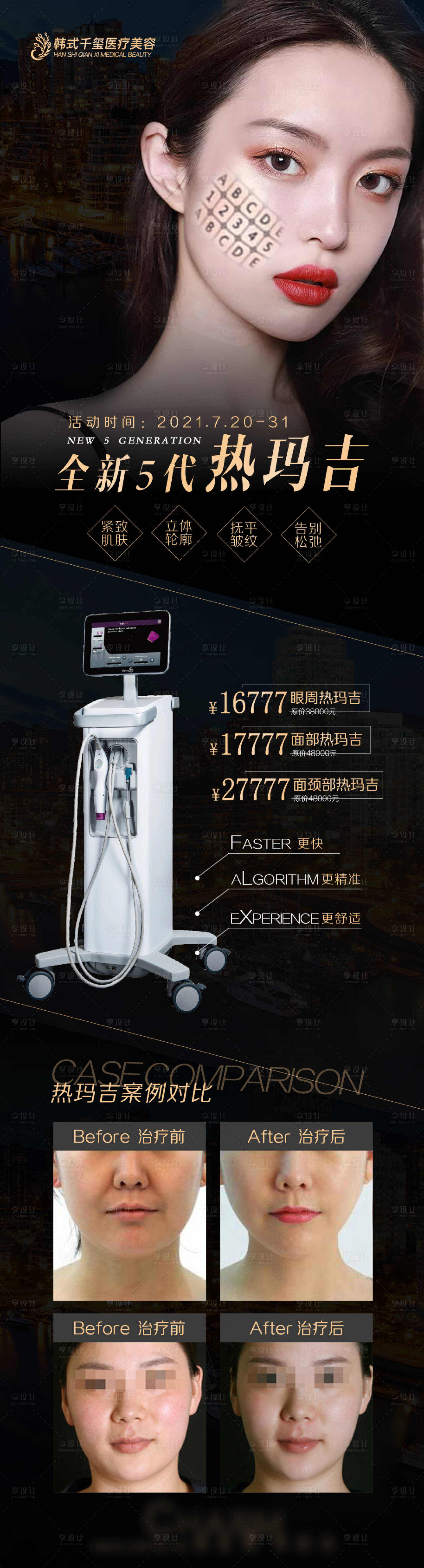源文件下載【享設計】搜索編號：59850005653588070【醫美儀器熱瑪吉長圖】