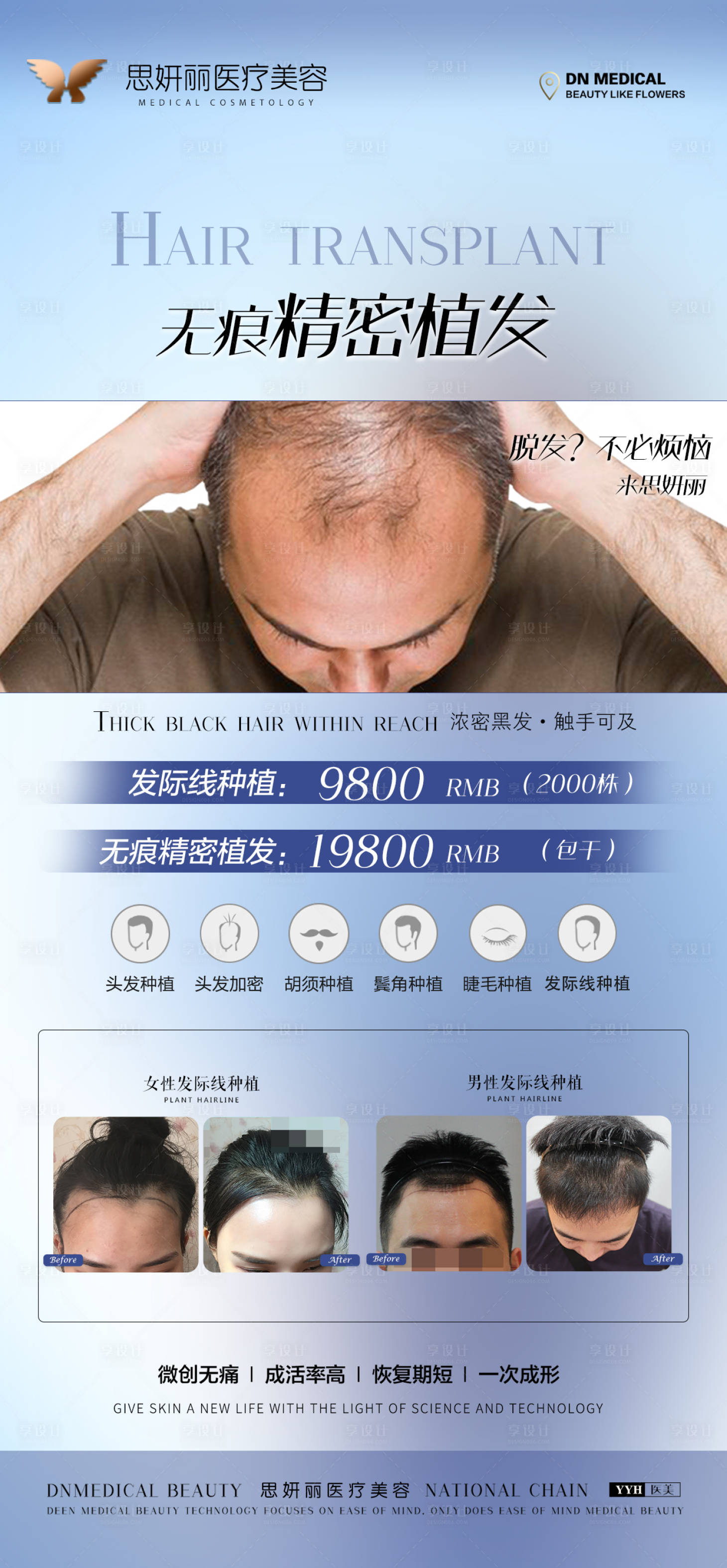 源文件下載【享設計】搜索編號：10580005473032376【植發發際線種植海報】