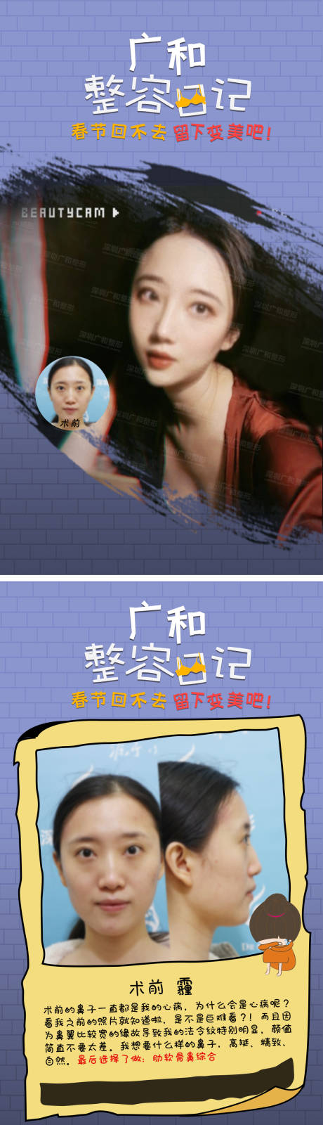 源文件下载【医美整容日记系列海报】编号：73150006173275895