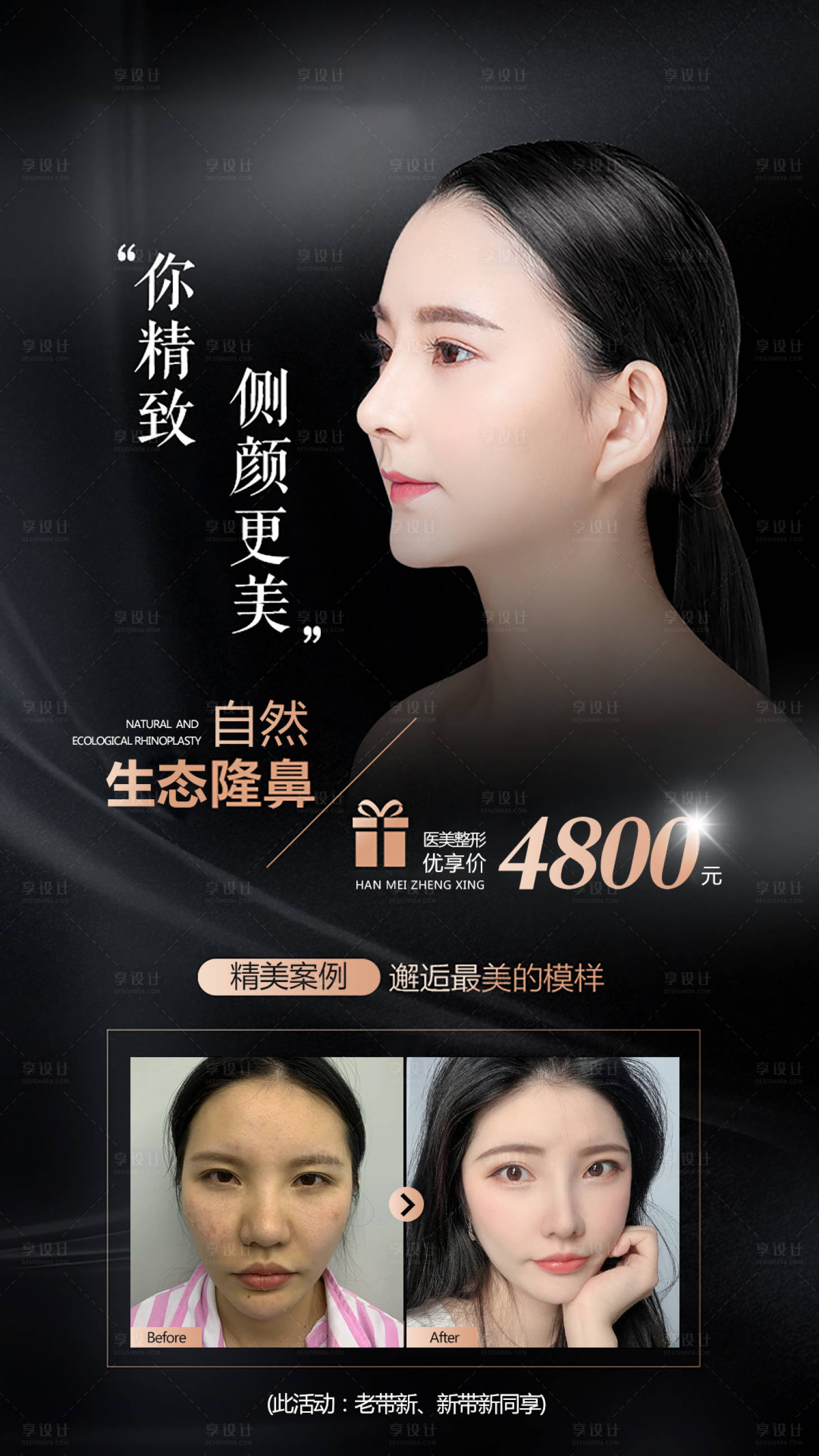 源文件下载【享设计】搜索编号：87760005922557690【医美隆鼻案例海报】