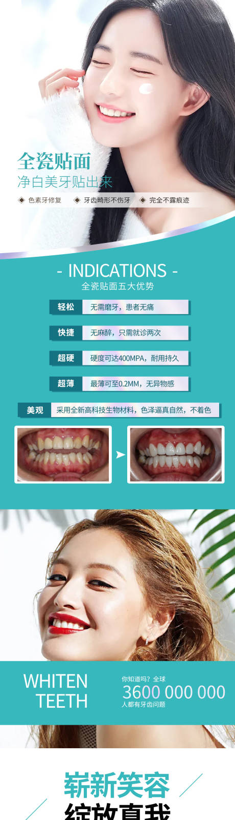 源文件下载【牙齿美白贴面项目海报】编号：55810005907317361