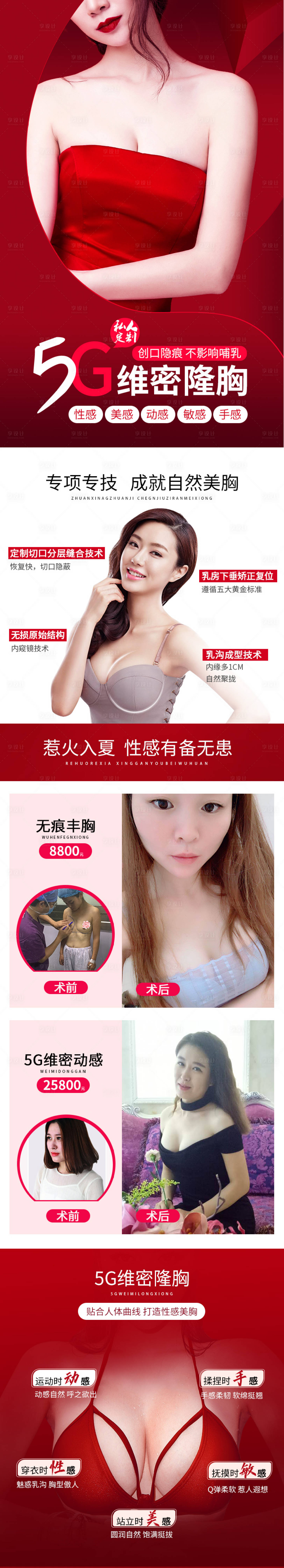源文件下載【享設(shè)計】搜索編號：36040005858805851【5G維密隆胸案例】