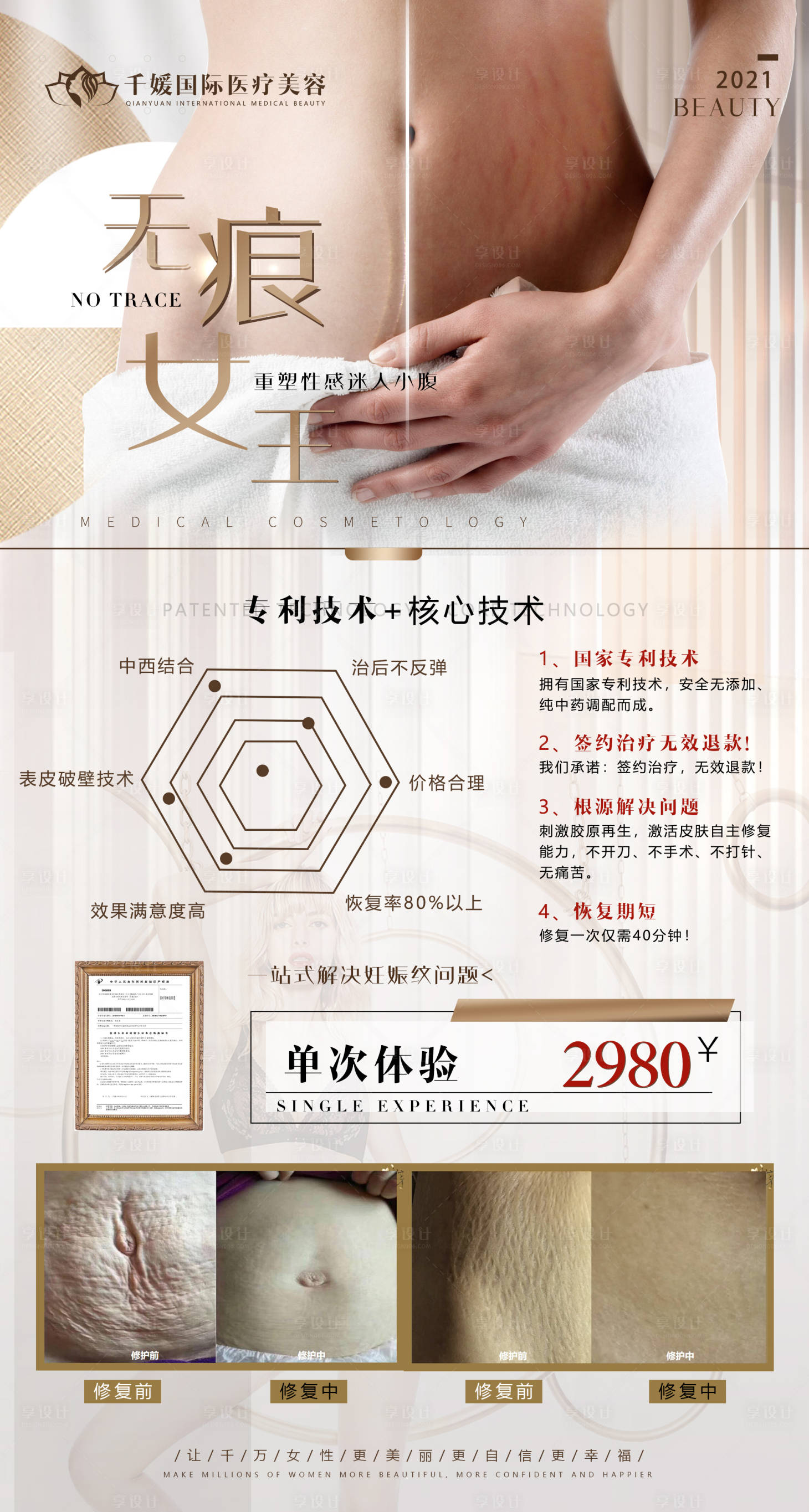 源文件下載【享設計】搜索編號：23040005898029827【祛除妊娠紋海報】