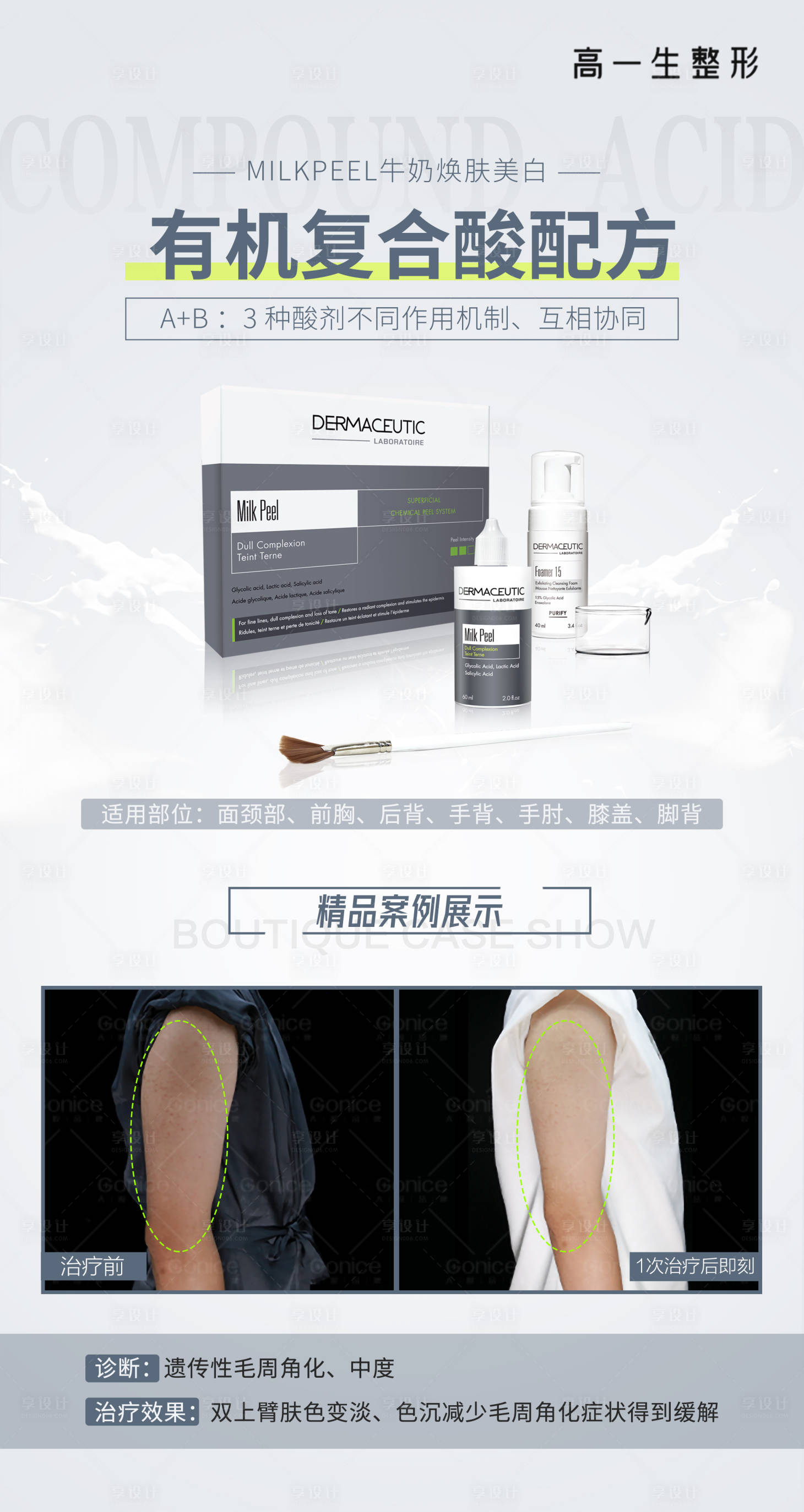 源文件下載【有機復合酸配方美白案例海報】編號：24180006238369309