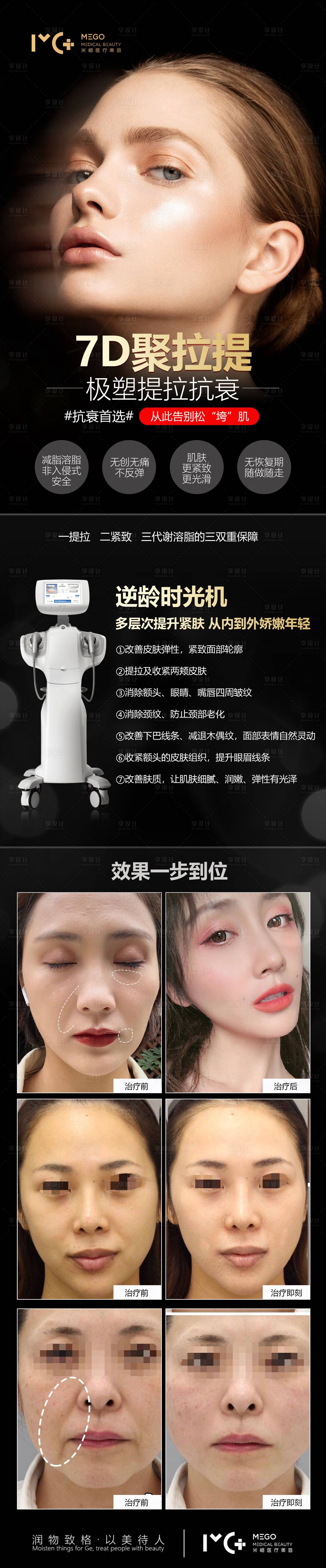源文件下載【享設計】搜索編號：29160006145422094【醫美7d聚拉提長圖海報】