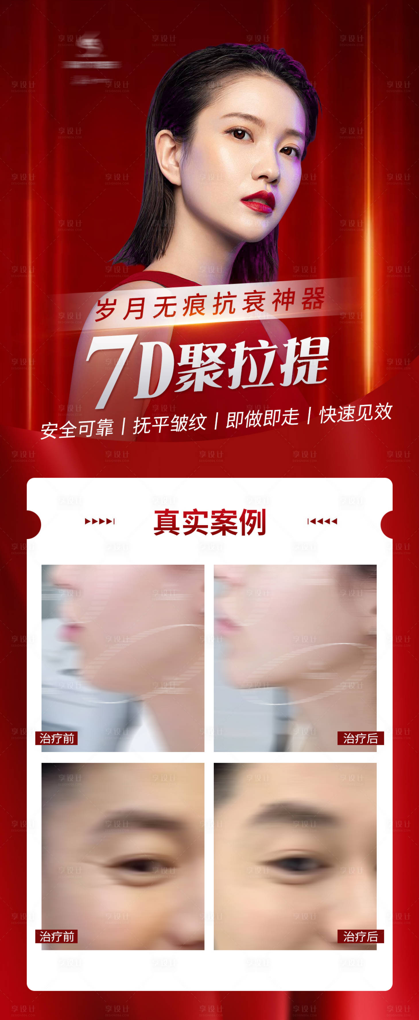 源文件下載【7D聚拉提抗衰宣傳海報】編號：77390006006351047