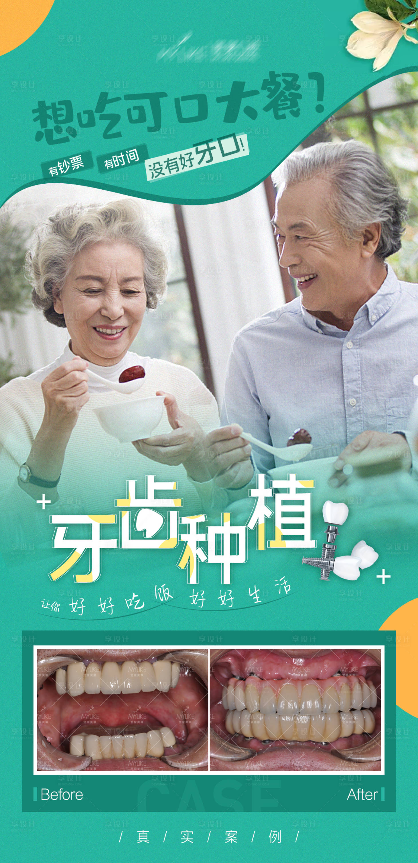 源文件下載【享設(shè)計(jì)】搜索編號(hào)：98880006074176426【牙齒種植宣傳海報(bào)】