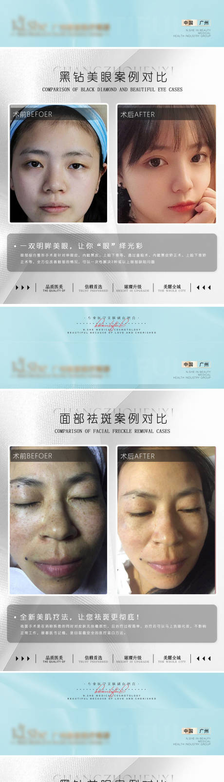 源文件下載【醫美案例圖】編號：69580005942467954