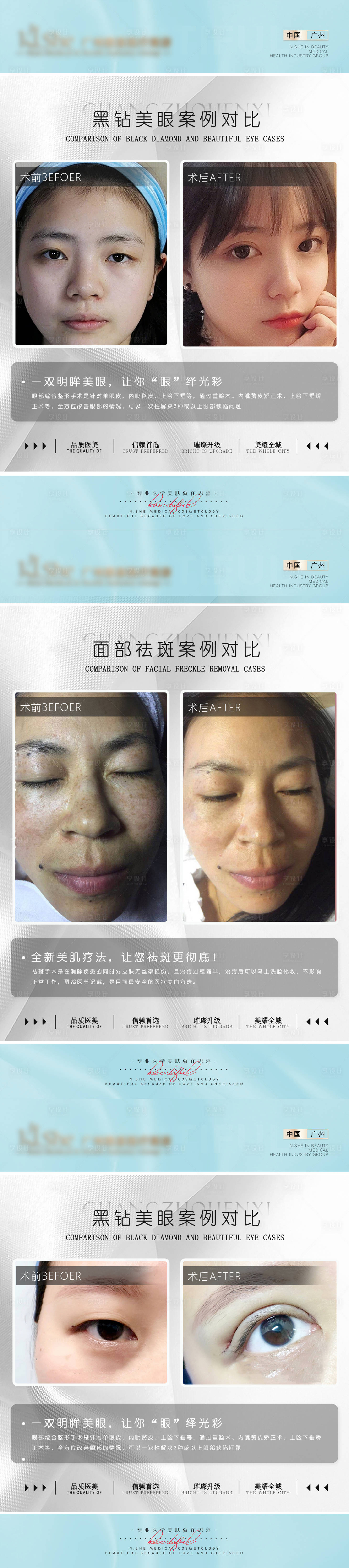 源文件下載【享設(shè)計】搜索編號：69580005942467954【醫(yī)美案例圖】
