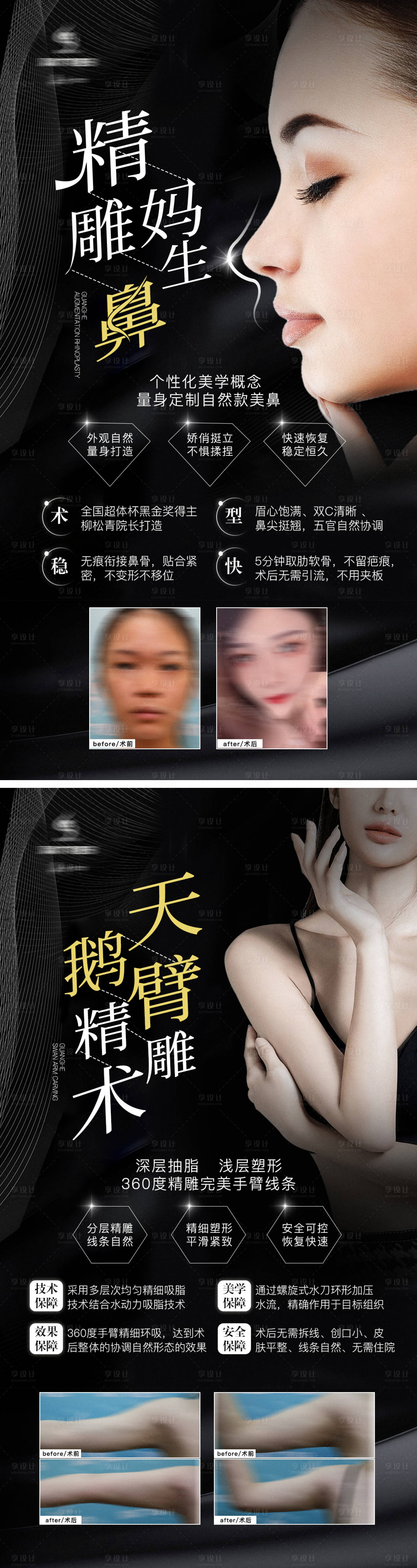 源文件下载【享设计】搜索编号：79650006104844086【医美隆鼻吸脂项目介绍海报】