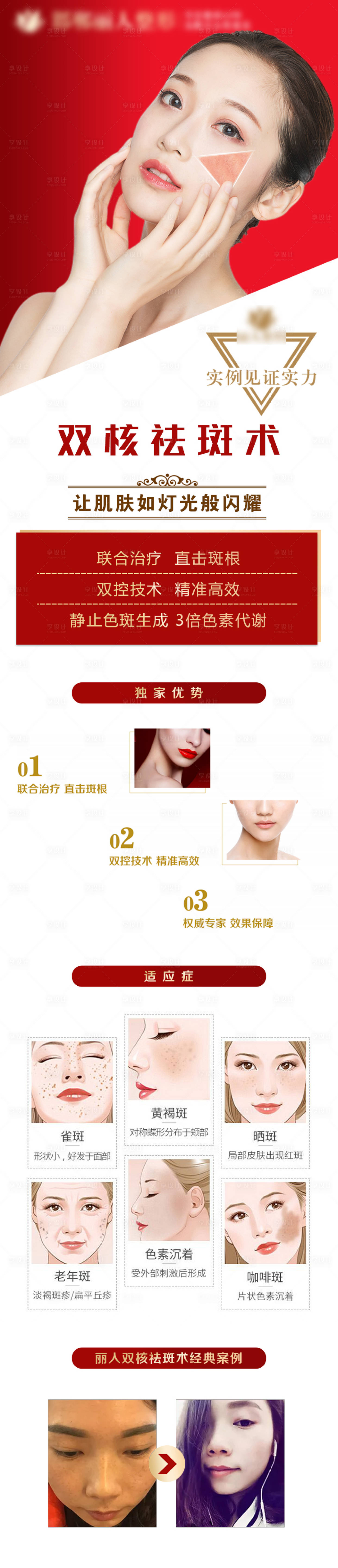 源文件下載【享設(shè)計】搜索編號：55160006141841582【整形醫(yī)美雙核光祛斑長圖海報】