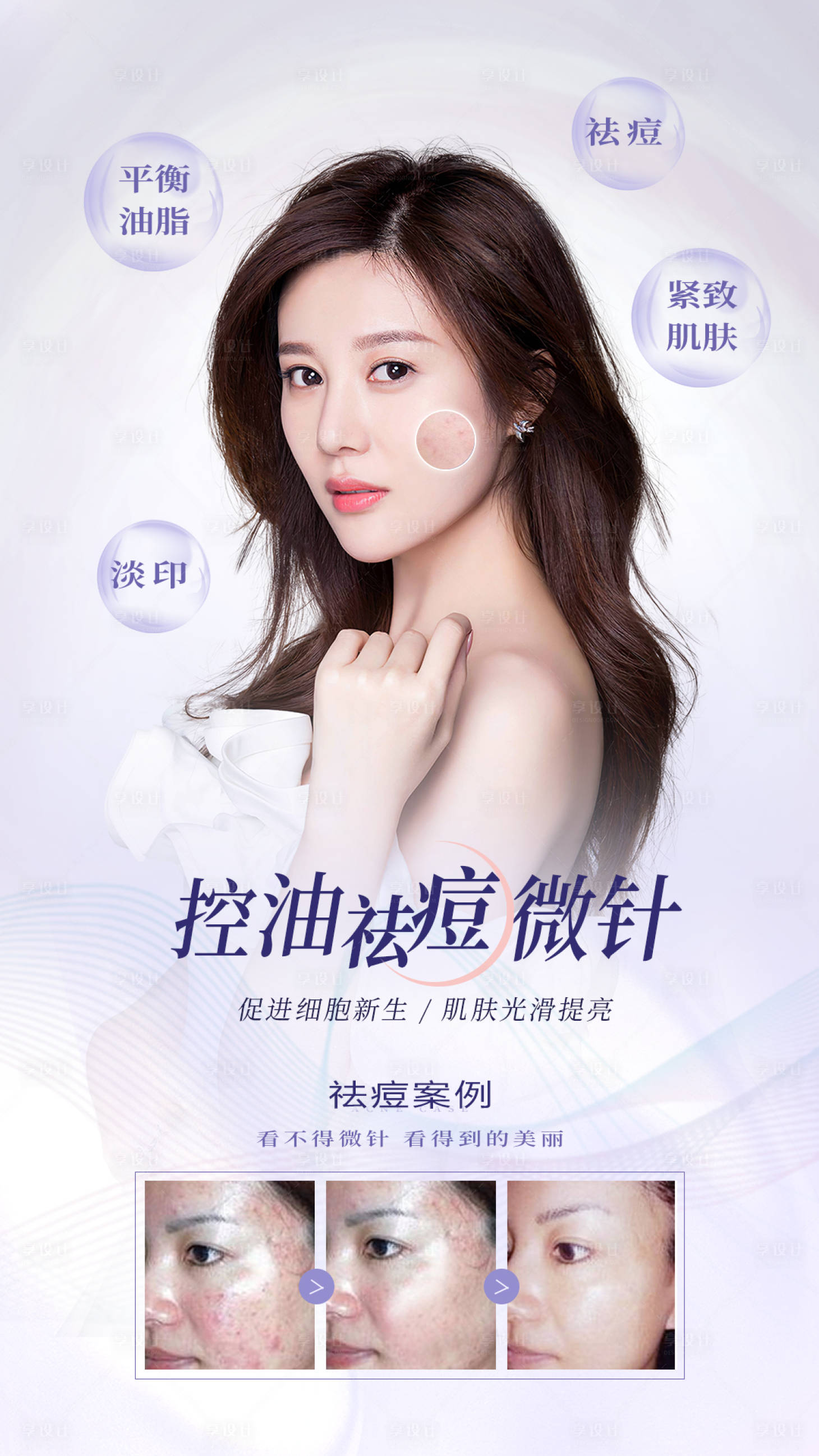源文件下载【享设计】搜索编号：96760006132573401【医美微针祛痘海报】