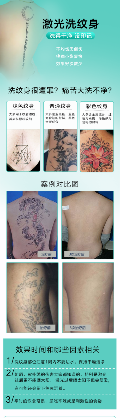 源文件下载【医美激光洗纹身详情页】编号：10970006059242211