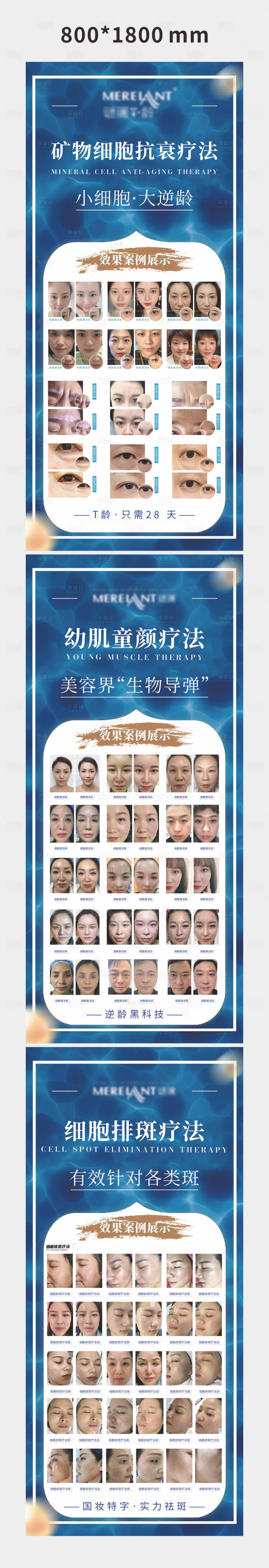 源文件下載【享設計】搜索編號：39180005984994939【醫美細胞抗衰療法系列展架】