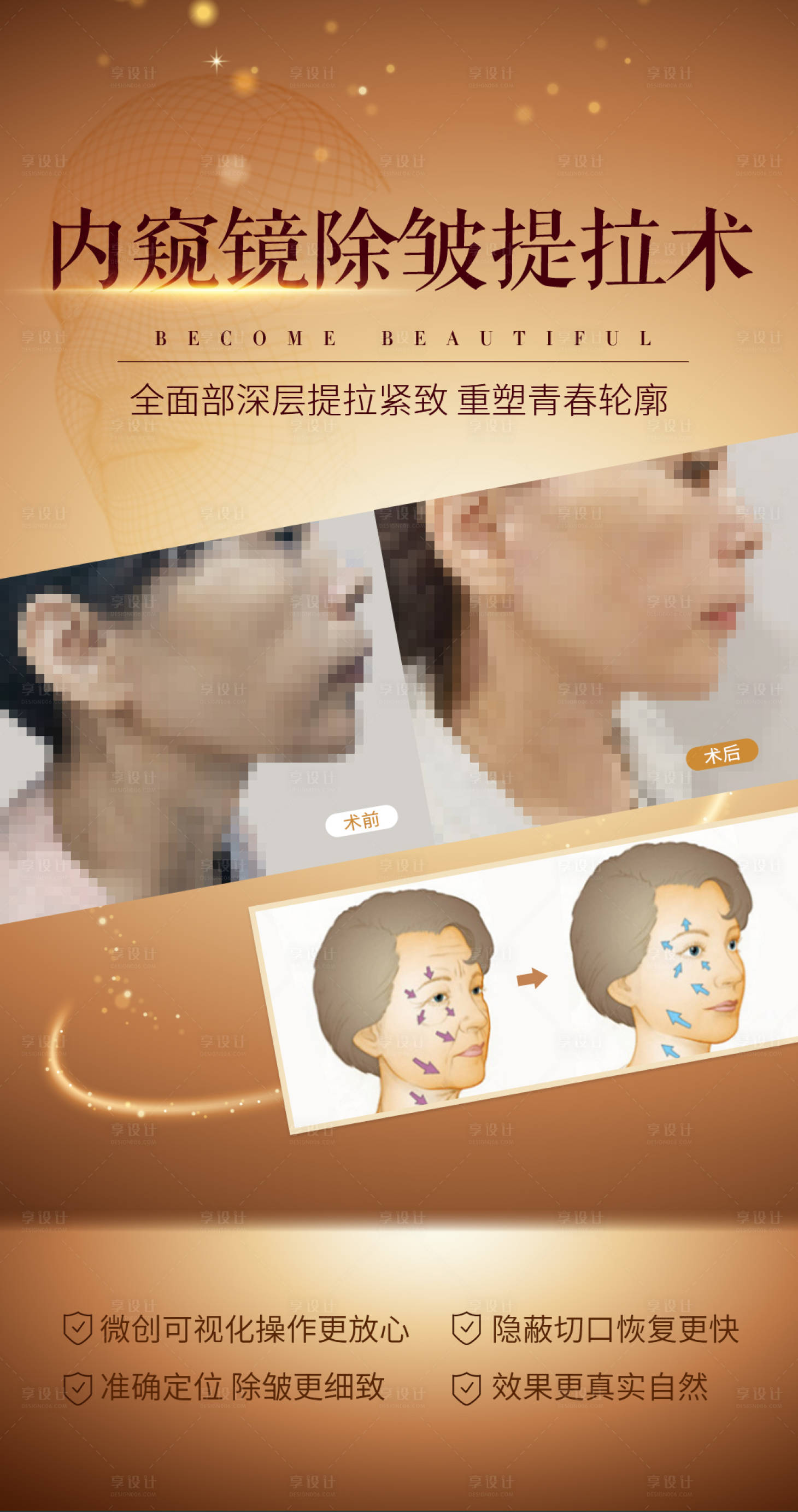 源文件下載【享設計】搜索編號：68230006193542528【內窺鏡除皺提升術海報】