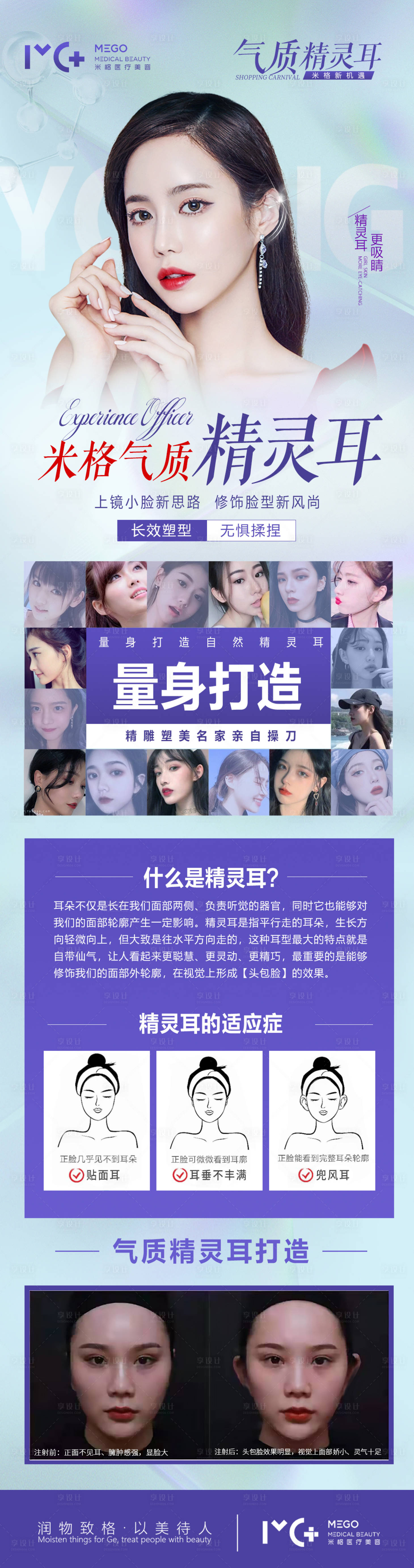 源文件下载【享设计】搜索编号：31180006144508202【医美项目新品精灵耳海报】