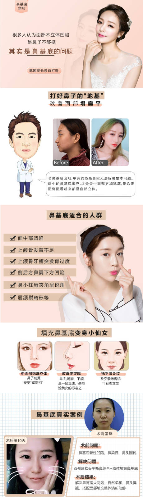 源文件下载【鼻基底详情页】编号：98700005934124421