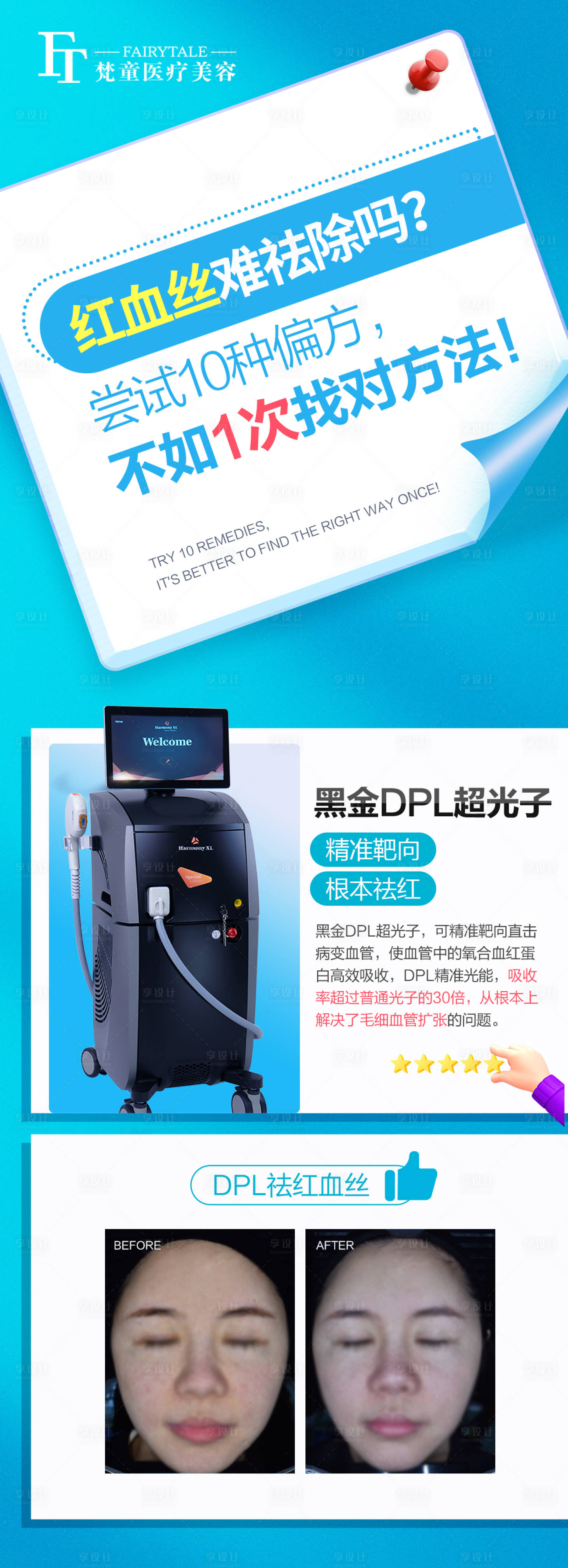 源文件下载【DPL祛红血丝医美海报】编号：14610006211655498