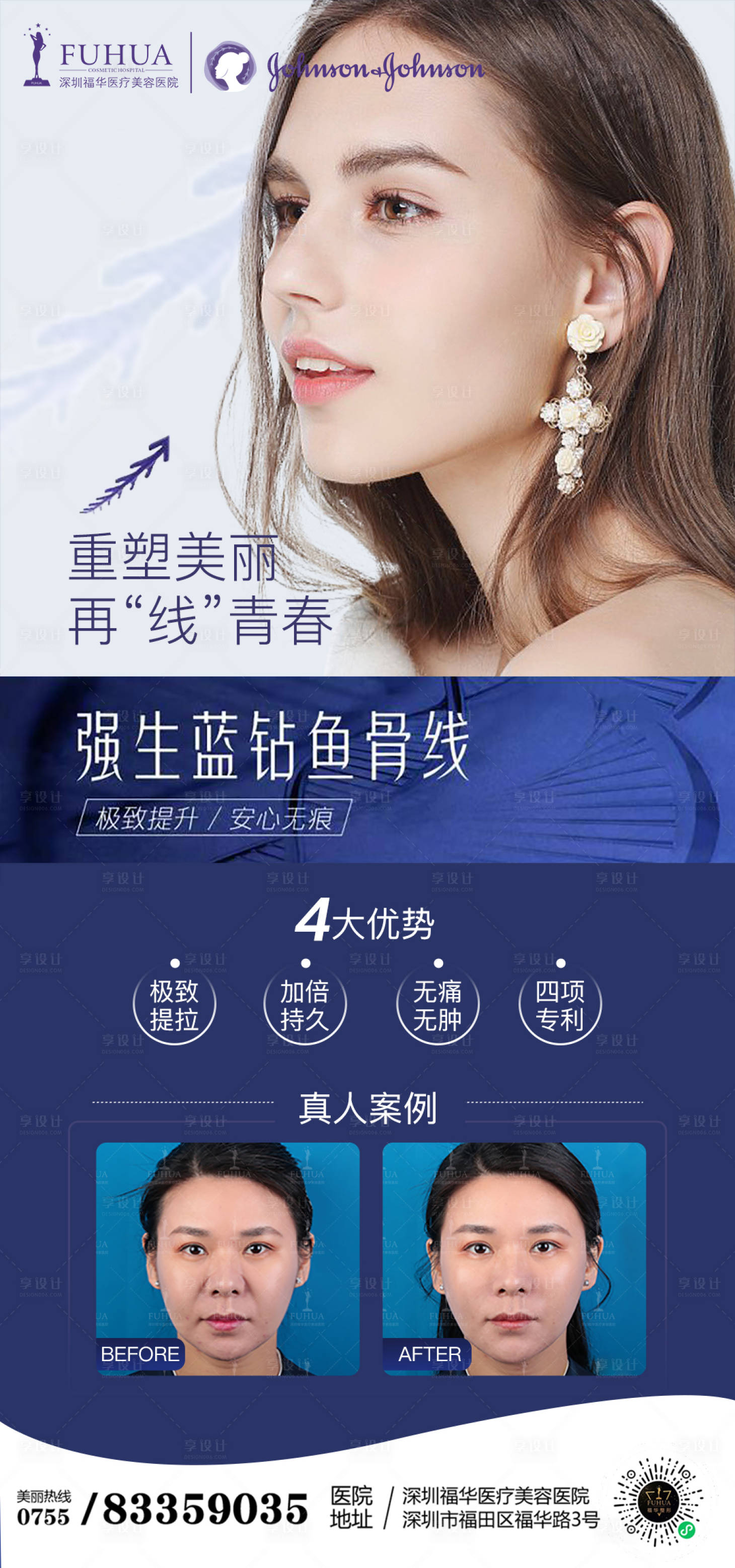 源文件下載【享設計】搜索編號：30100006205574738【醫美強生魚骨線線雕海報】