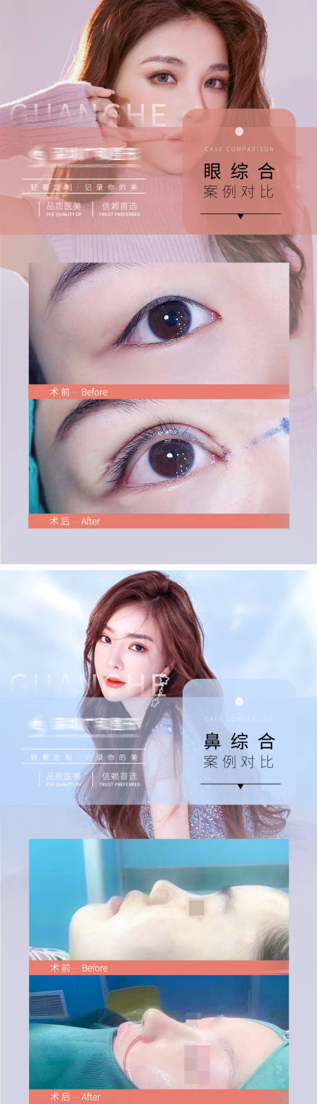 源文件下載【享設(shè)計】搜索編號：24100006158993643【醫(yī)美案例對比圖海報】