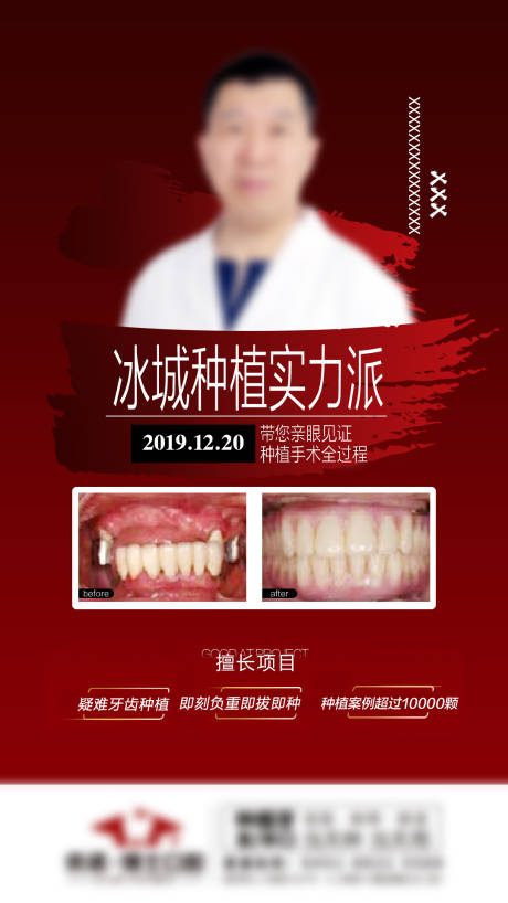 源文件下載【享設計】搜索編號：59770006046286962【口腔種植牙海報】