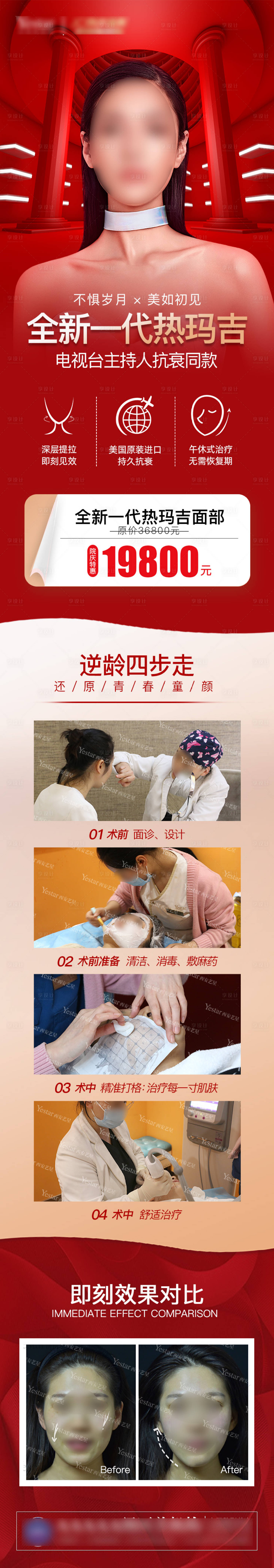 源文件下载【享设计】搜索编号：84650006079168911【医美热玛吉宣传图】