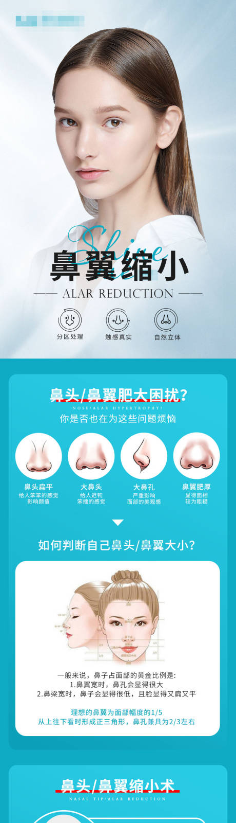 源文件下载【医美鼻部整形鼻翼缩小】编号：82380006276683596