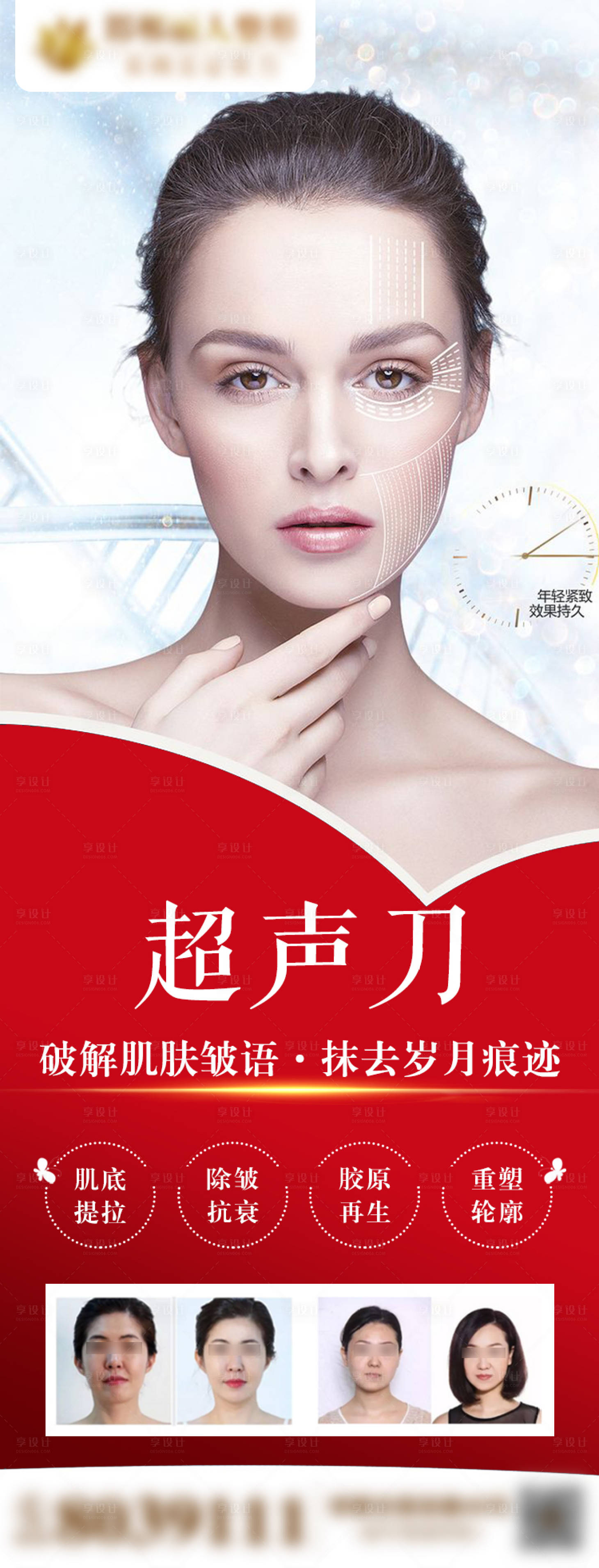 源文件下载【医美整形抗衰超声刀宣传展架】编号：75300006043919237