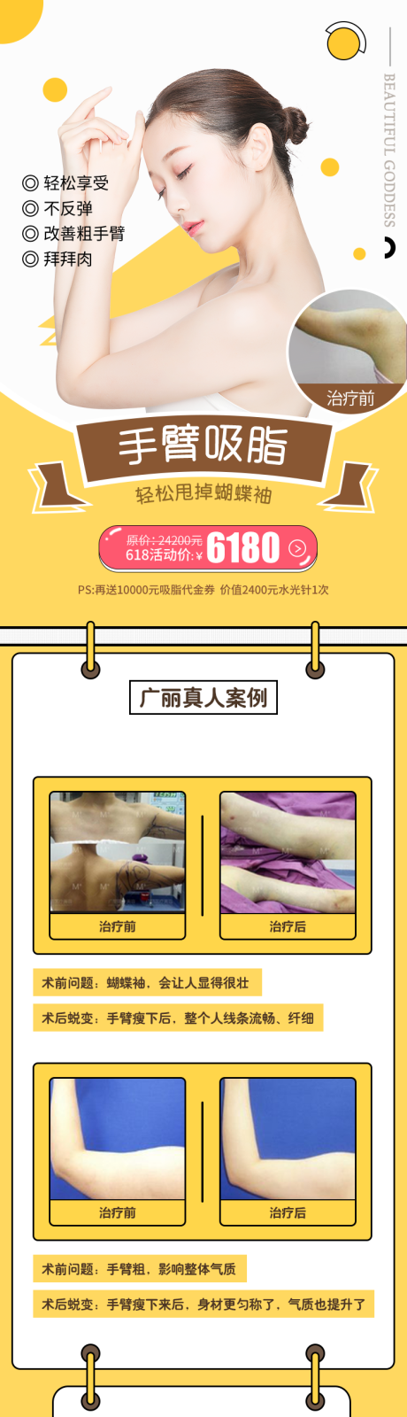 源文件下載【享設(shè)計(jì)】搜索編號(hào)：64670006059853932【醫(yī)美手臂吸脂詳情頁(yè)】