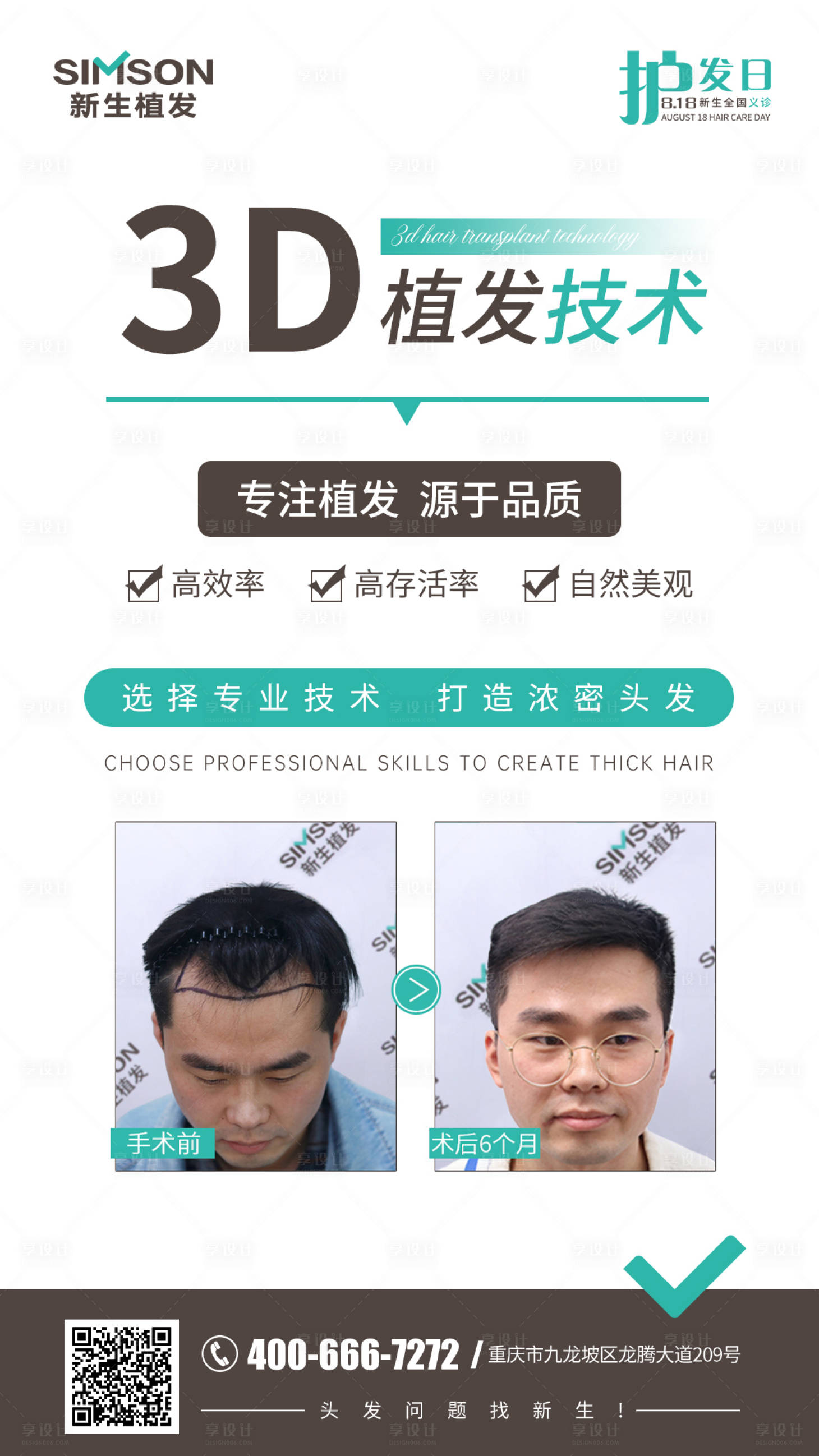源文件下載【享設計】搜索編號：84110006151563914【3D植發】