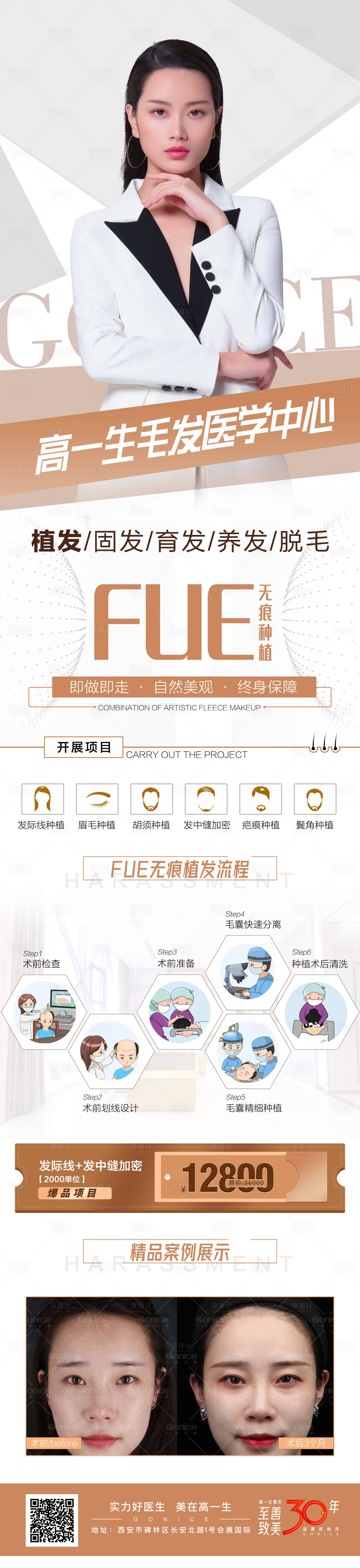 源文件下载【享设计】搜索编号：47120006240353793【无痕种植】