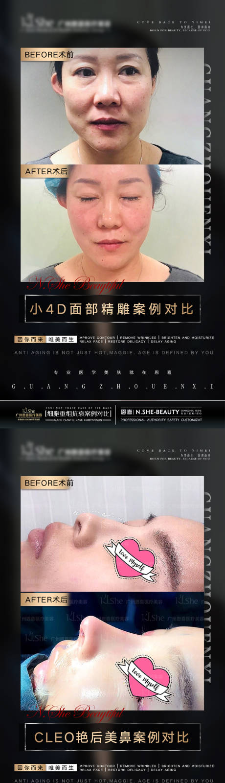 源文件下載【享設(shè)計(jì)】搜索編號(hào)：14980005942281818【醫(yī)美案例圖】