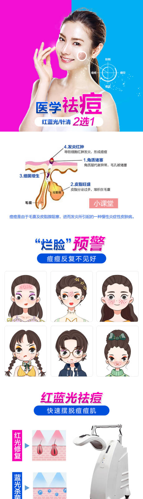 源文件下载【医学祛痘详情页】编号：56900006664562947