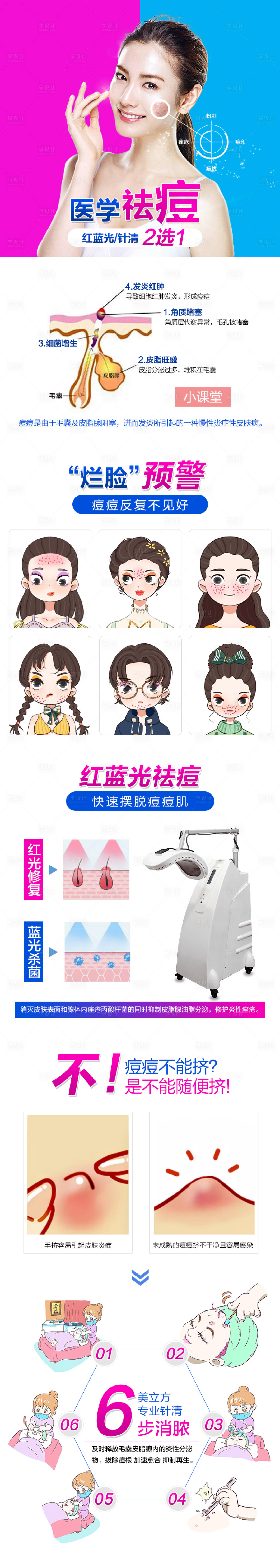 源文件下載【享設(shè)計】搜索編號：56900006664562947【醫(yī)學祛痘詳情頁】