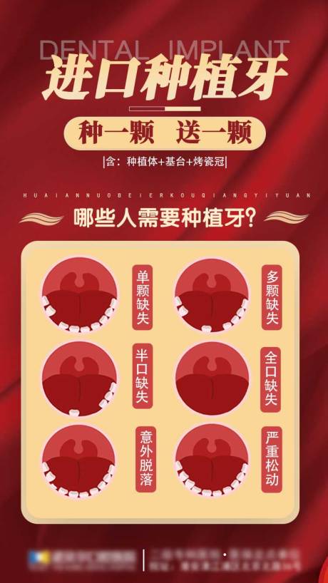 源文件下载【口腔医院种植牙】编号：52230006513778917