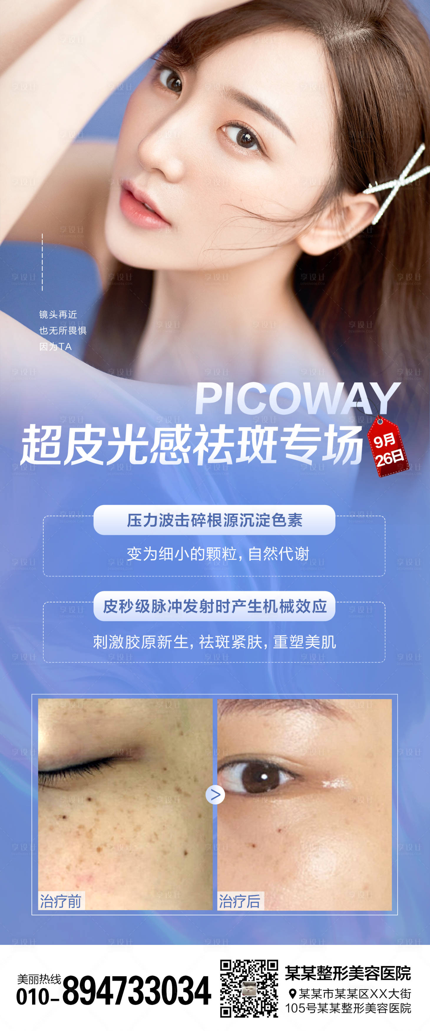 源文件下载【享设计】搜索编号：22080006490818441【祛斑海报】