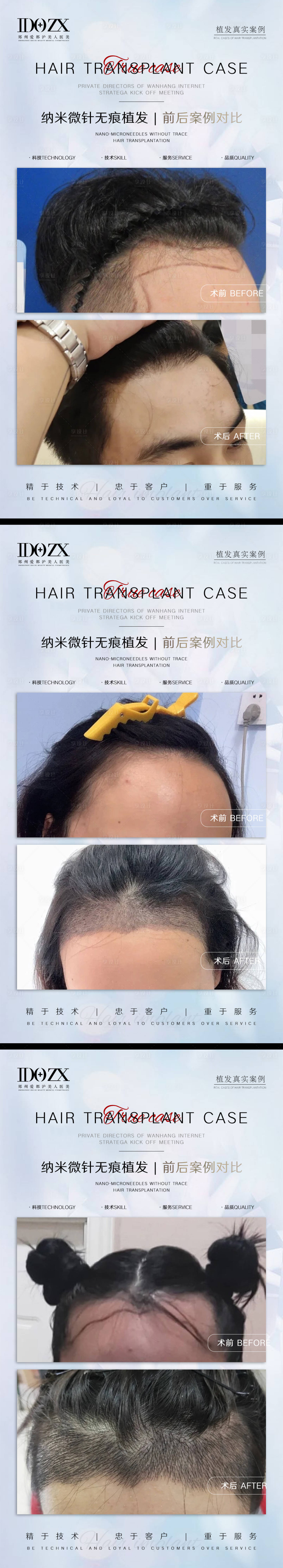 源文件下載【享設計】搜索編號：77490006476173063【醫美整形案例對比海報】