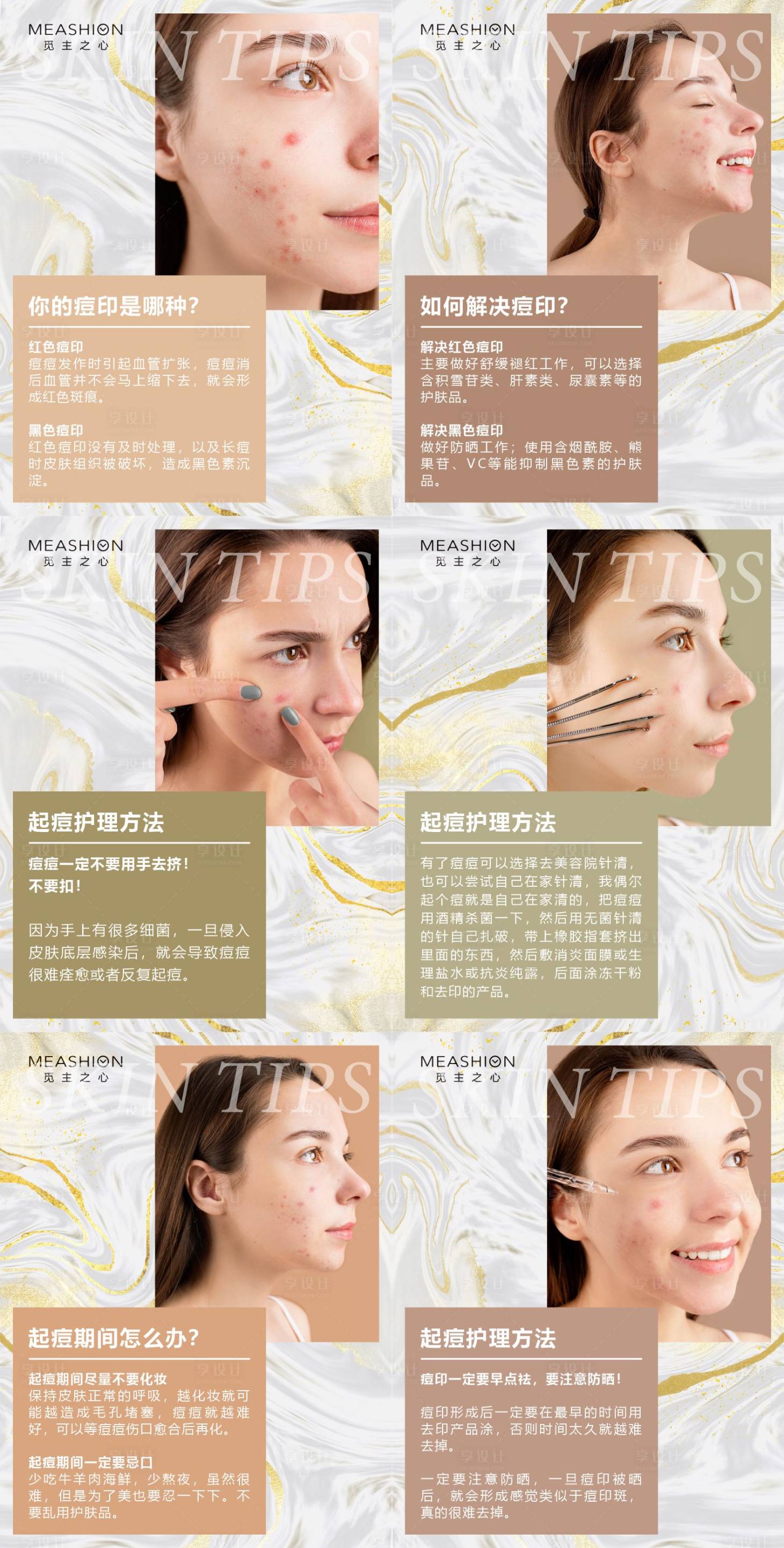 源文件下载【享设计】搜索编号：88010006637706413【痘痘小知识海报】