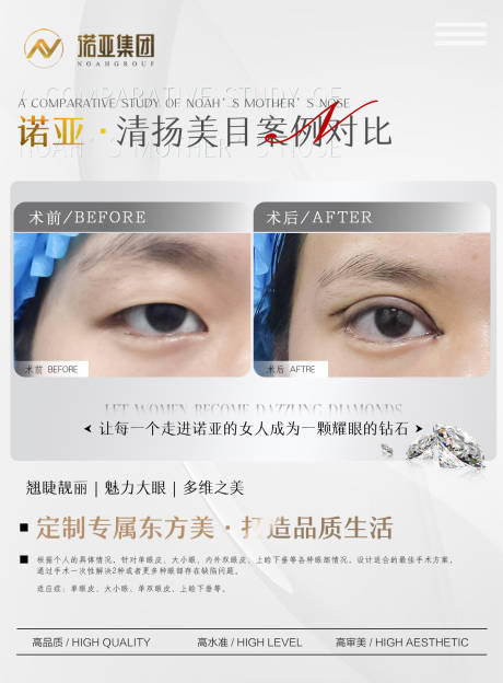 源文件下载【医美整形对比图】编号：37900006337053846