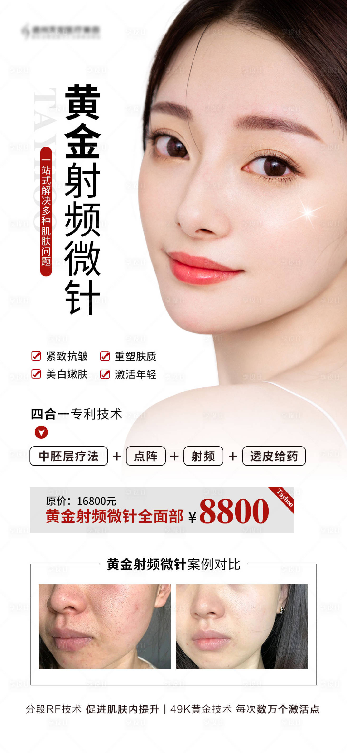 源文件下载【享设计】搜索编号：67430006512482585【黄金微针海报】