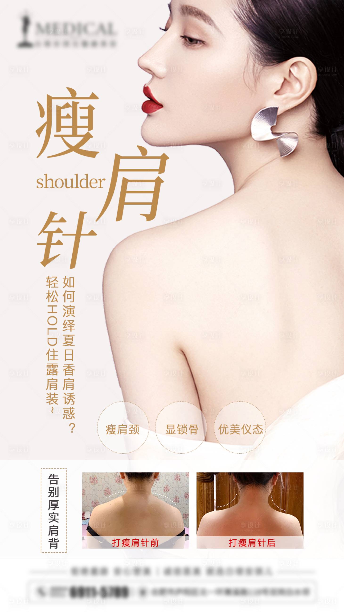 源文件下載【享設(shè)計(jì)】搜索編號：93050006320075937【醫(yī)美瘦肩針海報(bào)】