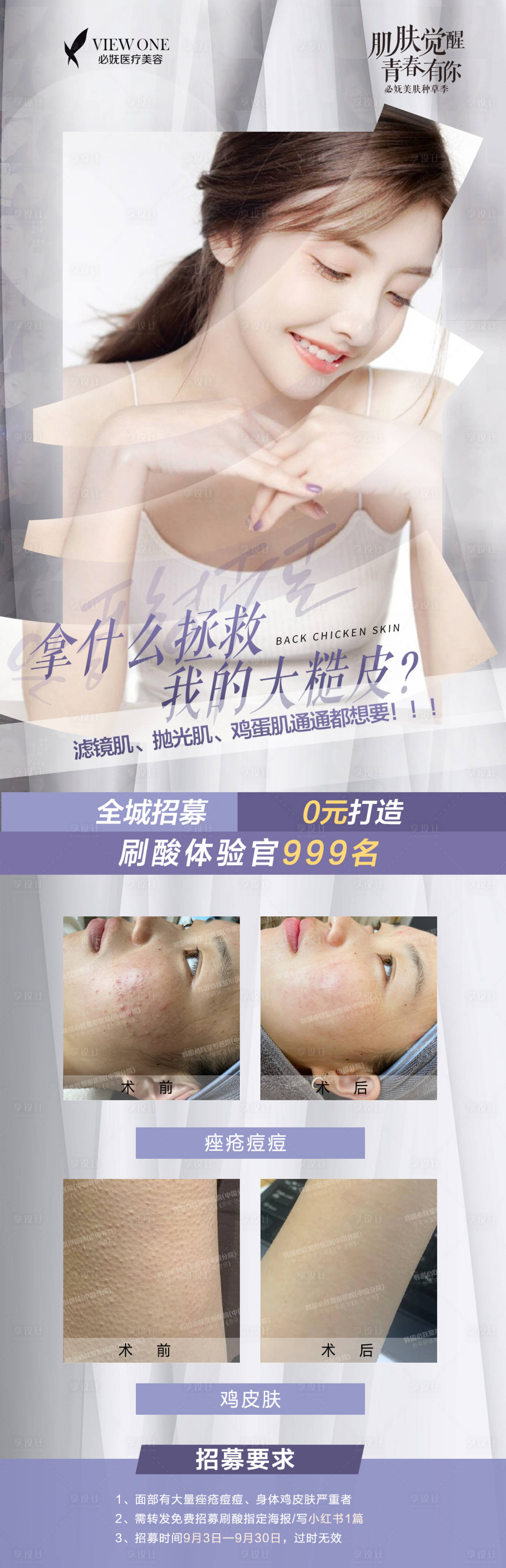 源文件下載【享設計】搜索編號：54060006332245341【醫美小清新創意招募案例長圖】