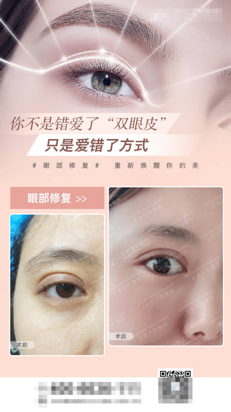 源文件下载【享设计】搜索编号：28090006427294189【双眼皮案例海报】