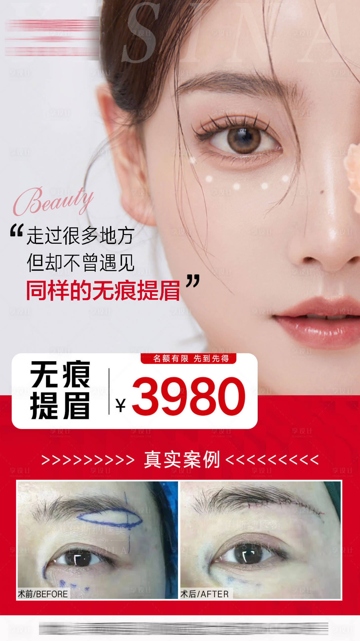 源文件下載【享設(shè)計(jì)】搜索編號(hào)：40720006570777900【醫(yī)美無(wú)痕提眉海報(bào)】