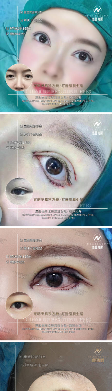 源文件下载【享设计】搜索编号：78660006461542816【医美整形案例对比海报】